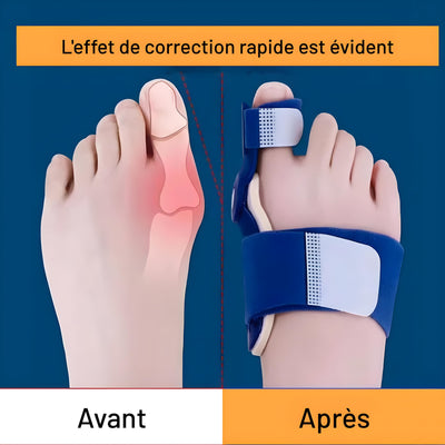 Accessoire souple pour orteils  et oignons– ajustable & confortable au quotidien