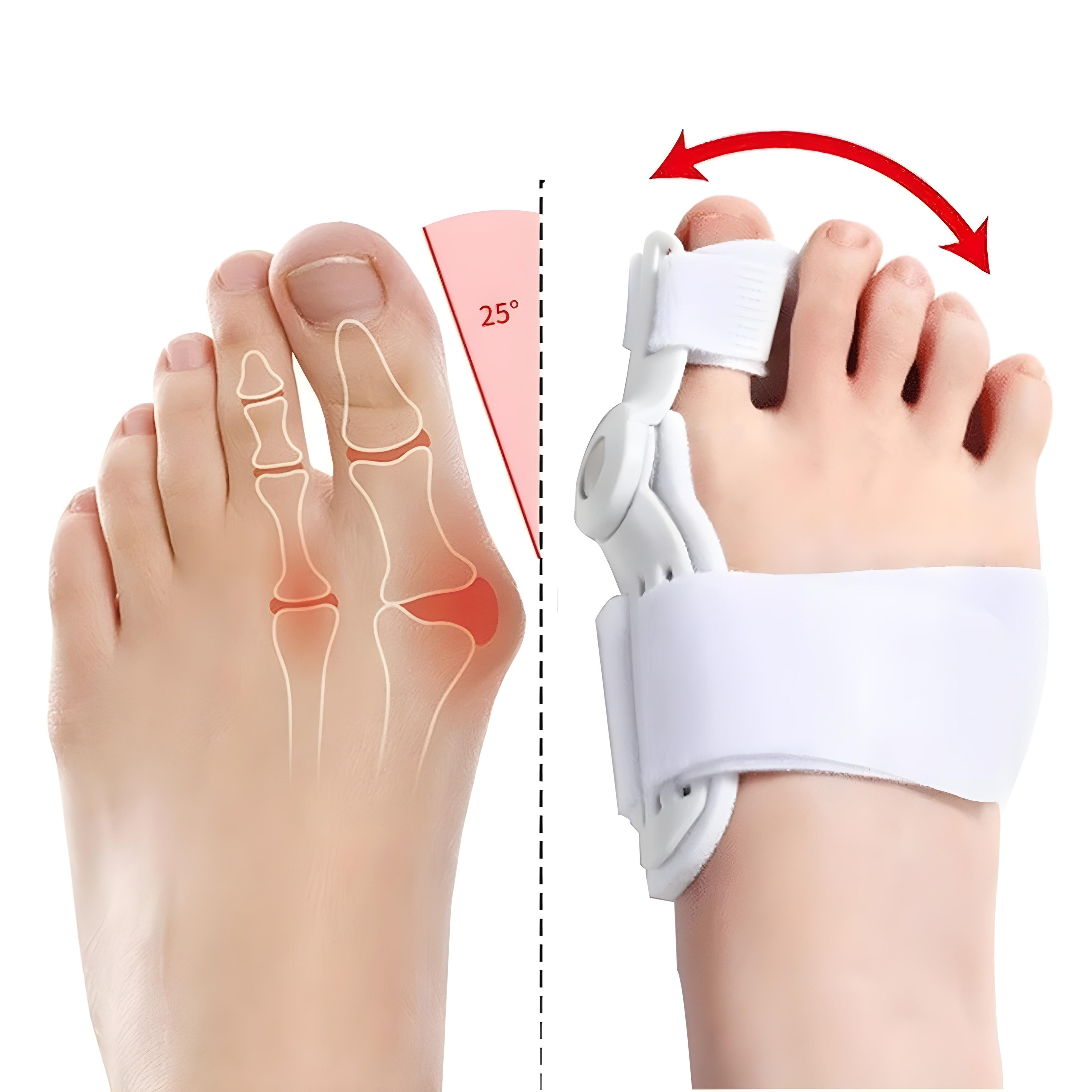 Accessoire souple pour orteils  et oignons– ajustable & confortable au quotidien